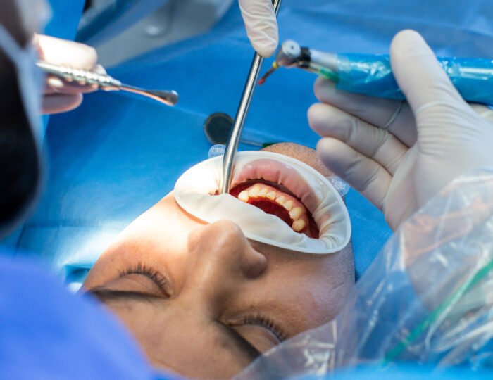 blog__0005_1 blog__0005_1